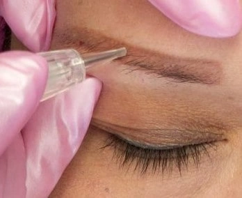 خدمات ریموو تتو قدیمی